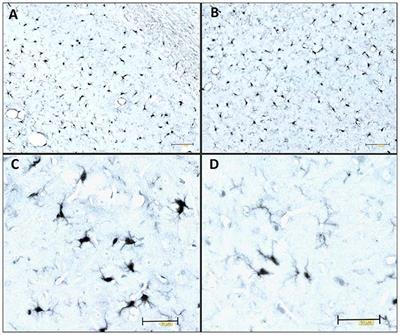 Role of Microglial Cells in Alzheimer’s Disease Tau Propagation